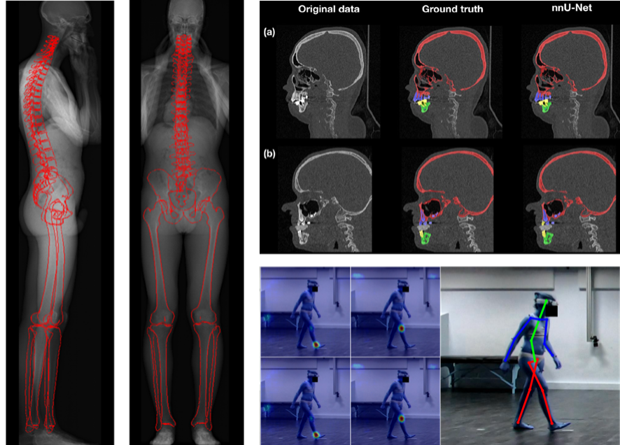 Annonce SB HDR Gajny