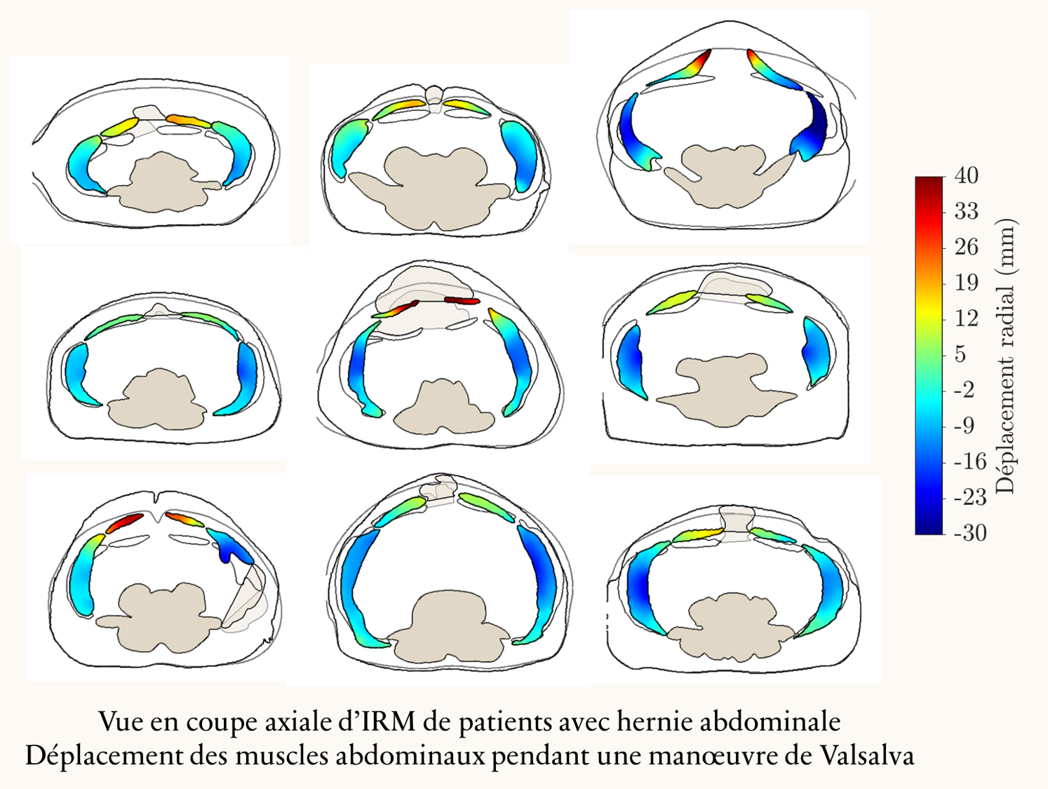 Preview JOPPIN these