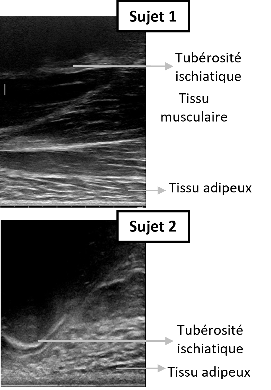 Both anatomy observed vertical