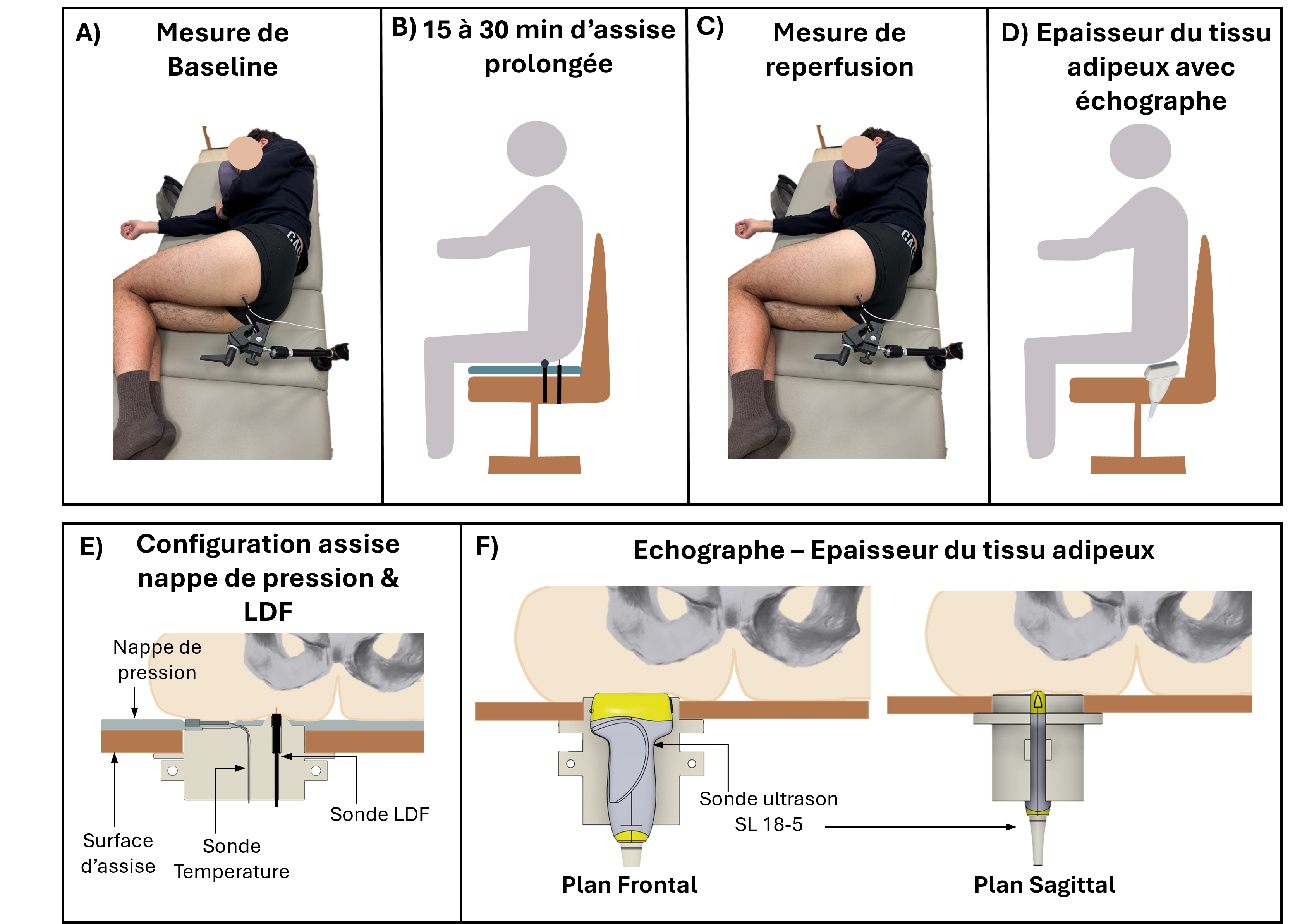 overview protocole french V2